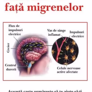 Cum să faci faţă migrenelor - Paperback brosat - Sue Dyson - Antet Revolution