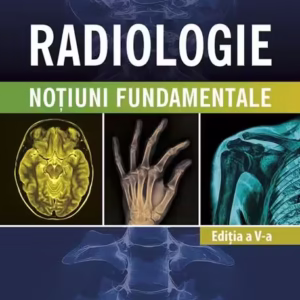 Radiologie - Paperback brosat - Thomas A. Farrell - All