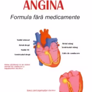 Cum să tratăm angina - Paperback brosat - Tom Rob Smith - Antet Revolution